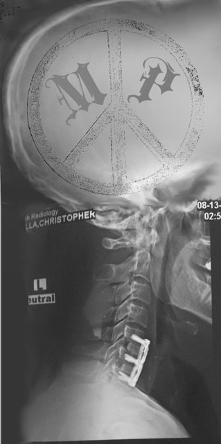 X-ray skull peace symbol artwork